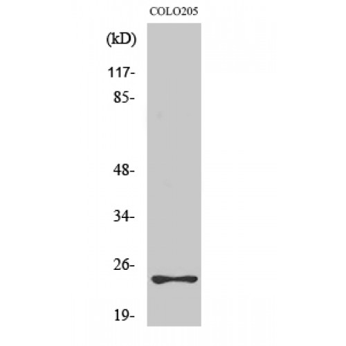 MED18 Antibody - Western blot of Med18 antibody