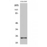 MED18 Antibody - Western blot of Med18 antibody