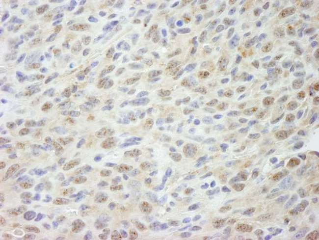 MED18 Antibody - Detection of Mouse MED18 by Immunohistochemistry. Sample: FFPE section of mouse squamous cell carcinoma. Antibody: Affinity purified rabbit anti-MED18 used at a dilution of 1:250.