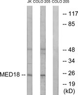 MED18 Antibody - Western blot analysis of lysates from COLO and Jurkat cells, using MED18 Antibody. The lane on the right is blocked with the synthesized peptide.