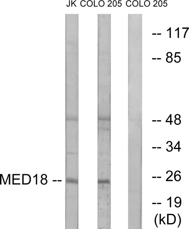 MED18 Antibody - Western blot analysis of lysates from COLO and Jurkat cells, using MED18 Antibody. The lane on the right is blocked with the synthesized peptide.