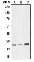 MED18 Antibody - Western blot analysis of MED18 expression in HEK293T (A); mouse brain (B); rat kidney (C) whole cell lysates.