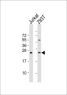 MED18 Antibody - All lanes : Anti-MED18 Antibody at 1:1000 dilution Lane 1: Jurkat whole cell lysates Lane 2: 293T whole cell lysates Lysates/proteins at 20 ug per lane. Secondary Goat Anti-Rabbit IgG, (H+L),Peroxidase conjugated at 1/10000 dilution Predicted band size : 24 kDa Blocking/Dilution buffer: 5% NFDM/TBST.