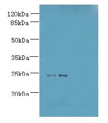 MED18 Antibody - Western blot. All lanes: MED18 antibody at 0.8 ug/ml. Lane 1: HeLa whole cell lysate. Lane 2: 293T whole cell lysate. Secondary Goat polyclonal to Rabbit IgG at 1:10000 dilution. Predicted band size: 24 kDa. Observed band size: 24 kDa.