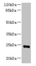 MED18 Antibody - Western blot All lanes: MED18 antibody at 0.8µg/ml + 293T whole cell lysate Secondary Goat polyclonal to rabbit IgG at 1/10000 dilution Predicted band size: 24 kDa Observed band size: 24 kDa