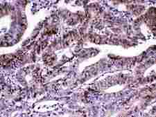 MED18 Antibody - Immunohistochemistry - Anti-MED18 Picoband Antibody