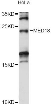 MED18 Antibody - Western blot analysis of extracts of HeLa cells, using MED18 antibody at 1:1000 dilution. The secondary antibody used was an HRP Goat Anti-Rabbit IgG (H+L) at 1:10000 dilution. Lysates were loaded 25ug per lane and 3% nonfat dry milk in TBST was used for blocking. An ECL Kit was used for detection and the exposure time was 15s.