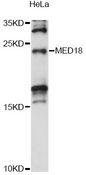 MED18 Antibody - Western blot analysis of extracts of HeLa cells, using MED18 antibody at 1:1000 dilution. The secondary antibody used was an HRP Goat Anti-Rabbit IgG (H+L) at 1:10000 dilution. Lysates were loaded 25ug per lane and 3% nonfat dry milk in TBST was used for blocking. An ECL Kit was used for detection and the exposure time was 15s.