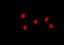 MED18 Antibody - Staining HeLa cells by IF/ICC. The samples were fixed with PFA and permeabilized in 0.1% Triton X-100, then blocked in 10% serum for 45 min at 25°C. The primary antibody was diluted at 1:200 and incubated with the sample for 1 hour at 37°C. An Alexa Fluor 594 conjugated goat anti-rabbit IgG (H+L) Ab, diluted at 1/600, was used as the secondary antibody.