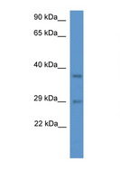 MED19 Antibody - MED19 antibody Western blot of Rat Liver lysate. Antibody concentration 1 ug/ml. This image was taken for the unconjugated form of this product. Other forms have not been tested.
