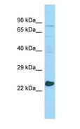 MED20 Antibody - MED20 antibody Western Blot of RPMI-8226.  This image was taken for the unconjugated form of this product. Other forms have not been tested.