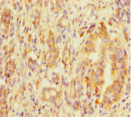 MED20 Antibody - Immunohistochemistry of paraffin-embedded human pancreatic tissue at dilution 1:100