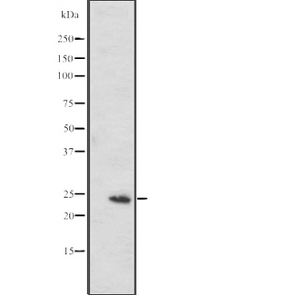 MED20 Antibody - Western blot analysis of MED20 expression in RPMI-8226 cells lysate. The lane on the left is treated with the antigen-specific peptide.