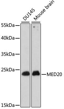 MED20 Antibody - Western blot analysis of extracts of various cell lines using MED20 Polyclonal Antibody at dilution of 1:1000.
