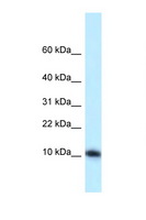 MED21 Antibody - MED21 / SURB7 antibody Western blot of Mouse Liver lysate. Antibody concentration 1 ug/ml.  This image was taken for the unconjugated form of this product. Other forms have not been tested.