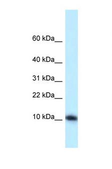 MED21 Antibody - MED21 / SURB7 antibody Western blot of Mouse Liver lysate. Antibody concentration 1 ug/ml.  This image was taken for the unconjugated form of this product. Other forms have not been tested.