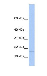 MED21 Antibody - Fetal brain lysate. Antibody concentration: 1.0 ug/ml. Gel concentration: 10-20%.  This image was taken for the unconjugated form of this product. Other forms have not been tested.