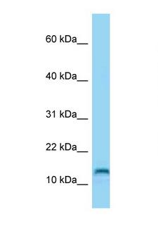 MED21 Antibody - MED21 / SURB7 antibody Western blot of HeLa Cell lysate. Antibody concentration 1 ug/ml.  This image was taken for the unconjugated form of this product. Other forms have not been tested.