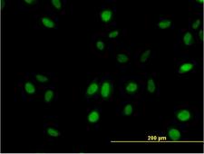 MED21 Antibody - Immunofluorescence of monoclonal antibody to SURB7 on HeLa cell. [antibody concentration 10 ug/ml]