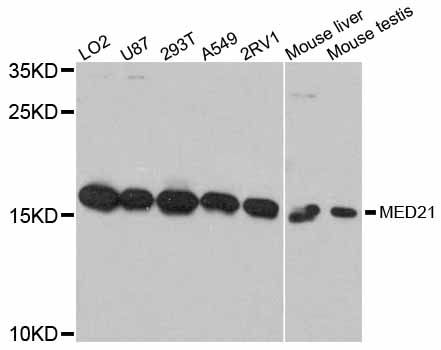 MED21 Antibody - Western blot analysis of extracts of various cell lines, using MED21 antibody at 1:3000 dilution. The secondary antibody used was an HRP Goat Anti-Rabbit IgG (H+L) at 1:10000 dilution. Lysates were loaded 25ug per lane and 3% nonfat dry milk in TBST was used for blocking. An ECL Kit was used for detection and the exposure time was 60s.
