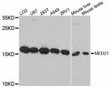 MED21 Antibody - Western blot analysis of extracts of various cell lines, using MED21 antibody at 1:3000 dilution. The secondary antibody used was an HRP Goat Anti-Rabbit IgG (H+L) at 1:10000 dilution. Lysates were loaded 25ug per lane and 3% nonfat dry milk in TBST was used for blocking. An ECL Kit was used for detection and the exposure time was 60s.
