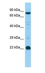 MED22 Antibody - MED22 antibody Western Blot of HeLa.  This image was taken for the unconjugated form of this product. Other forms have not been tested.