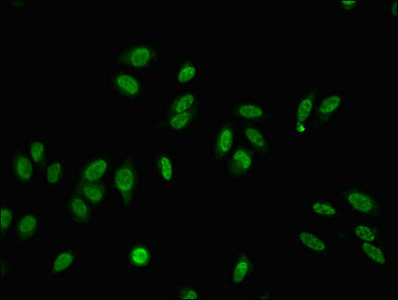 MED22 Antibody - Immunofluorescent analysis of Hela cells using MED22 Antibody at dilution of 1:100 and Alexa Fluor 488-congugated AffiniPure Goat Anti-Rabbit IgG(H+L)