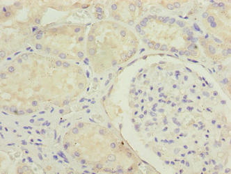 MED22 Antibody - Immunohistochemistry of paraffin-embedded human kidney tissue using MED22 Antibody at dilution of 1:100