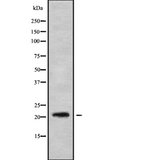 MED22 Antibody - Western blot analysis of MED22 using NIH-3T3 whole cells lysates