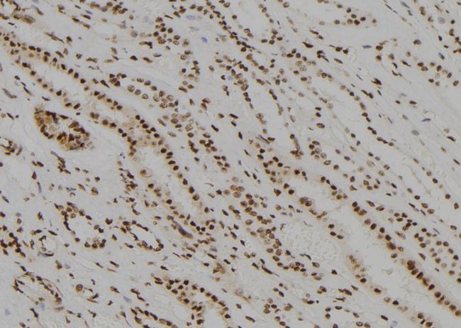 MED22 Antibody - 1:100 staining human kidney tissue by IHC-P. The sample was formaldehyde fixed and a heat mediated antigen retrieval step in citrate buffer was performed. The sample was then blocked and incubated with the antibody for 1.5 hours at 22°C. An HRP conjugated goat anti-rabbit antibody was used as the secondary.