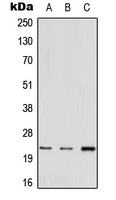 MED22 Antibody - Western blot analysis of MED22 expression in A549 (A); mouse heart (B); rat liver (C) whole cell lysates.