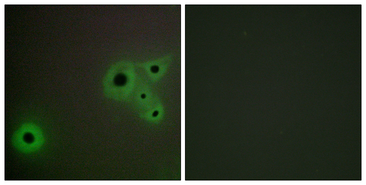 MED23 / SUR2 Antibody - Immunofluorescence analysis of A549 cells, using MED23 Antibody. The picture on the right is blocked with the synthesized peptide.