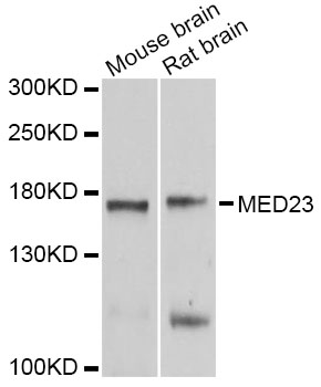 MED23 / SUR2 Antibody - Western blot analysis of extracts of various cell lines, using MED23 antibody at 1:1000 dilution. The secondary antibody used was an HRP Goat Anti-Rabbit IgG (H+L) at 1:10000 dilution. Lysates were loaded 25ug per lane and 3% nonfat dry milk in TBST was used for blocking. An ECL Kit was used for detection and the exposure time was 10s.