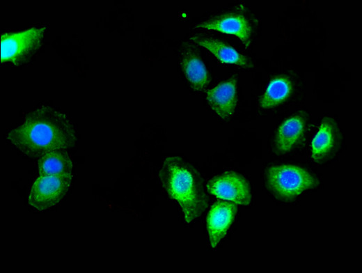 MED23 / SUR2 Antibody - Immunofluorescent analysis of A549 cells using MED23 Antibody at a dilution of 1:100 and Alexa Fluor 488-congugated AffiniPure Goat Anti-Rabbit IgG(H+L)