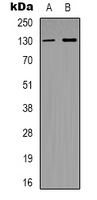 MED23 / SUR2 Antibody - Western blot analysis of SUR2 expression in HeLa (A); MCF7 (B) whole cell lysates.