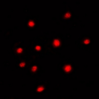 MED23 / SUR2 Antibody - Immunofluorescent analysis of SUR2 staining in HeLa cells. Formalin-fixed cells were permeabilized with 0.1% Triton X-100 in TBS for 5-10 minutes and blocked with 3% BSA-PBS for 30 minutes at room temperature. Cells were probed with the primary antibody in 3% BSA-PBS and incubated overnight at 4 deg C in a humidified chamber. Cells were washed with PBST and incubated with a DyLight 594-conjugated secondary antibody (red) in PBS at room temperature in the dark. DAPI was used to stain the cell nuclei (blue).
