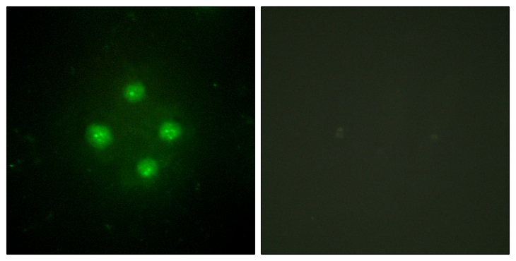 MED24 / TRAP100 Antibody - Immunofluorescence analysis of HUVEC cells, using MED24 Antibody. The picture on the right is blocked with the synthesized peptide.