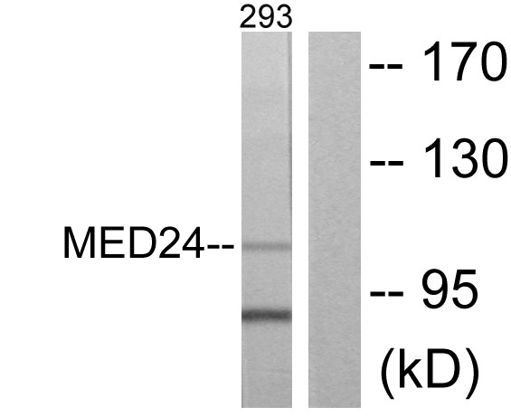 MED24 / TRAP100 Antibody - Western blot analysis of lysates from 293 cells, using MED24 Antibody. The lane on the right is blocked with the synthesized peptide.