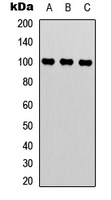 MED24 / TRAP100 Antibody - Western blot analysis of TRAP100 expression in HepG2 (A); HEK293T (B); HeLa (C) whole cell lysates.