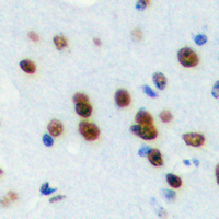 MED24 / TRAP100 Antibody - Immunohistochemical analysis of TRAP100 staining in human brain formalin fixed paraffin embedded tissue section. The section was pre-treated using heat mediated antigen retrieval with sodium citrate buffer (pH 6.0). The section was then incubated with the antibody at room temperature and detected using an HRP conjugated compact polymer system. DAB was used as the chromogen. The section was then counterstained with hematoxylin and mounted with DPX.
