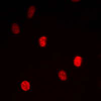 MED24 / TRAP100 Antibody - Immunofluorescent analysis of TRAP100 staining in HepG2 cells. Formalin-fixed cells were permeabilized with 0.1% Triton X-100 in TBS for 5-10 minutes and blocked with 3% BSA-PBS for 30 minutes at room temperature. Cells were probed with the primary antibody in 3% BSA-PBS and incubated overnight at 4 deg C in a humidified chamber. Cells were washed with PBST and incubated with a DyLight 594-conjugated secondary antibody (red) in PBS at room temperature in the dark. DAPI was used to stain the cell nuclei (blue).