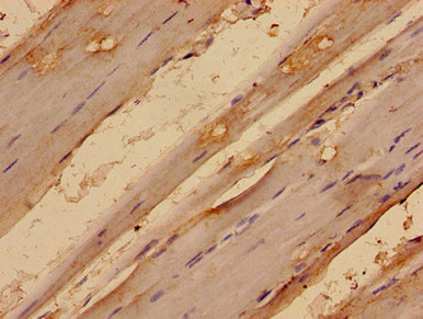MED24 / TRAP100 Antibody - Immunohistochemistry analysis of human skeletal muscle tissue using MED24 Antibody at dilution of 1:100