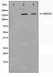 MED24 / TRAP100 Antibody - Western blot of A549 and HUVEC cell lysate using MED24 Antibody