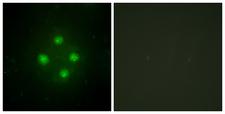 MED24 / TRAP100 Antibody - Peptide - + Immunofluorescence analysis of HUVEC cells, using MED24 antibody.
