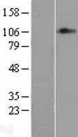 MED24 / TRAP100 Protein - Western validation with an anti-DDK antibody * L: Control HEK293 lysate R: Over-expression lysate