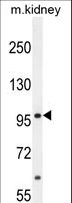 MED25 Antibody - MED25 Antibody western blot of mouse kidney tissue lysates (35 ug/lane). The MED25 antibody detected the MED25 protein (arrow).