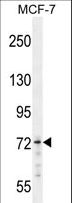 MED25 Antibody - MED25 Antibody (western blot of MCF-7 cell line lysates (35 ug/lane). The MED25 antibody detected the MED25 protein (arrow).