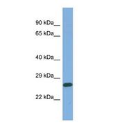 MED25 Antibody - Western blot of Human OVCAR-3. MED25 antibody dilution 1.0 ug/ml.  This image was taken for the unconjugated form of this product. Other forms have not been tested.