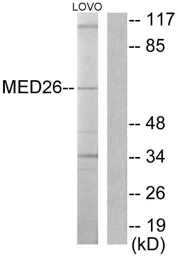 MED26 / CRSP7 Antibody - Western blot analysis of lysates from LOVO cells, using MED26 Antibody. The lane on the right is blocked with the synthesized peptide.
