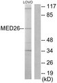 MED26 / CRSP7 Antibody - Western blot analysis of lysates from LOVO cells, using MED26 Antibody. The lane on the right is blocked with the synthesized peptide.